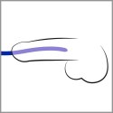Silicone Dilator Set You2Toys Silicone Dilator Set You2Toys
