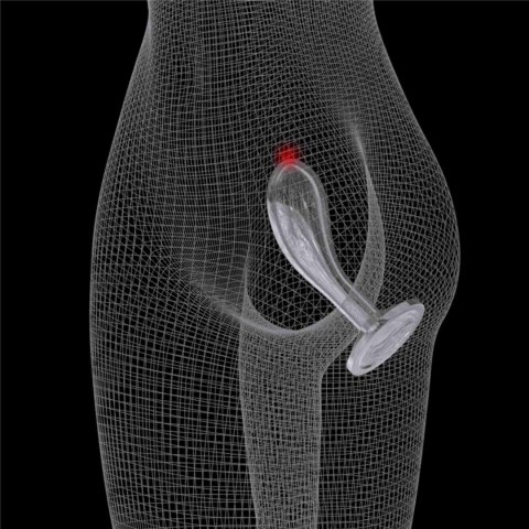 Flawless Clear Prostate Plug 6.0'' Lovetoy Flawless Clear Prostate Plug 6.0'' Lovetoy