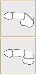 Metallic Silicone Cock ring se You2Toys Metallic Silicone Cock ring se You2Toys